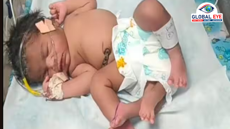4 கைகள், 4 கால்களுடன் பிறந்தது அதிசயக் குழந்தை! மத்திய பிரதேசத்தில் மருத்துவர்கள் வியப்பு!